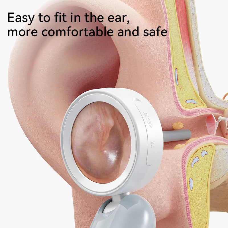1.38'' Ear Camera Wit IPS Display and 1080P Camera Ear Check Portable